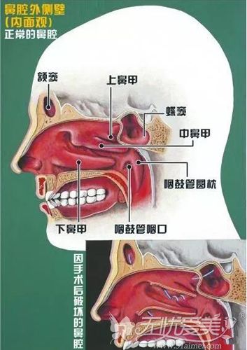 正常人的鼻腔内图片图片