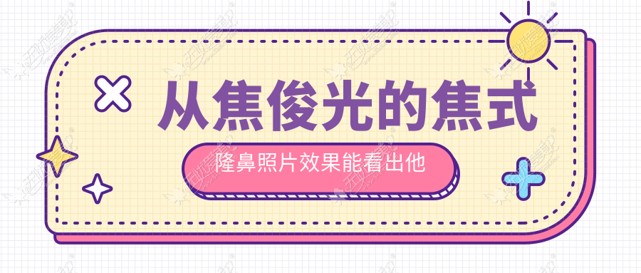 从焦俊光的焦式隆鼻照片效果能看出他做鼻子风格偏海鸥鼻