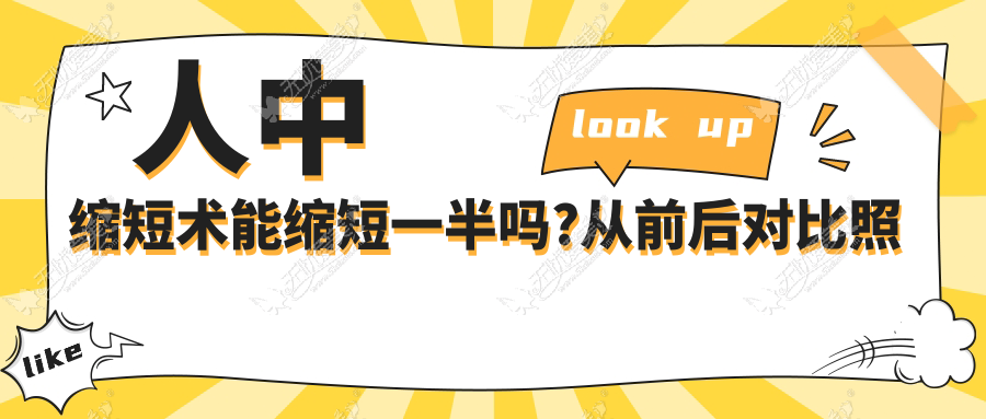 人中缩短术能缩短一半吗?从前后对比照片上看是可以实现的