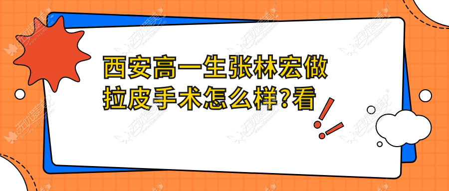 西安高一生张林宏做拉皮手术怎么样?看面部拉皮实例来判断