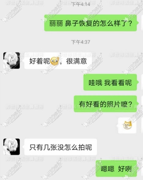 郭世伟医生做鼻子的风格