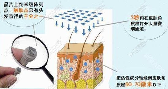 武汉美基元纳米，更安全、更有效、更先进!