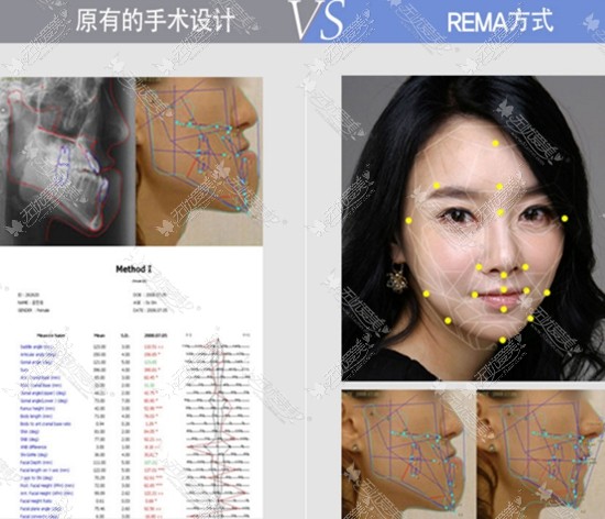 逆推算分析方式