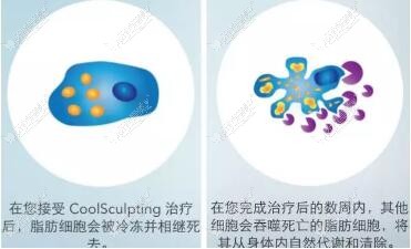 酷塑减脂原理揭秘