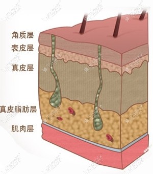 韩国BK整形医院拉皮手术优势