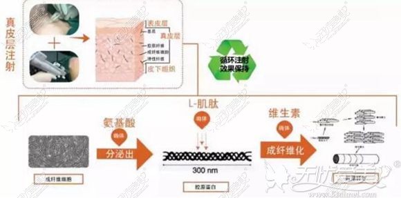 溧阳智美星嗨体赋活针除皱原理