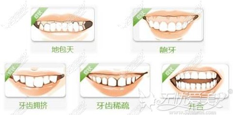 各种需要进行牙齿矫正的牙型