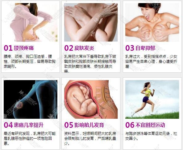 乳房肥大带来的痛苦