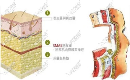 唐山美联臣拉皮优势