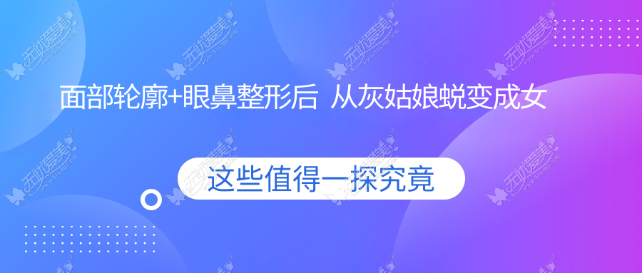 面部轮廓+眼鼻整形后  从灰姑娘蜕变成女神