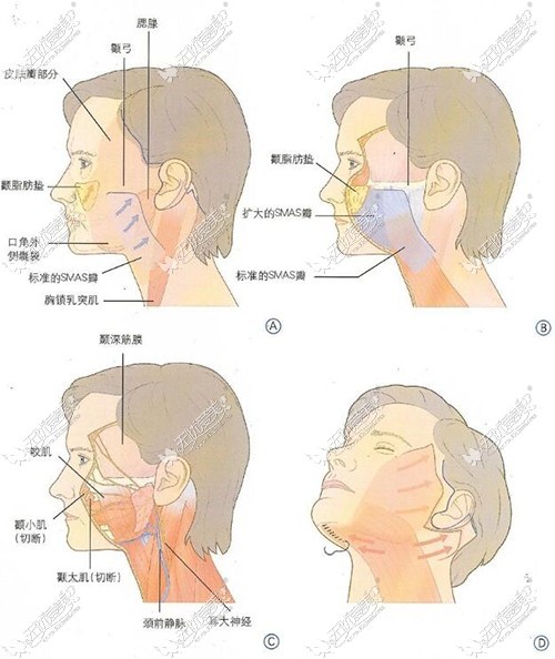 密速提提拉的部位