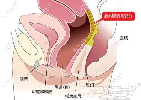 韩国好手艺后方腔圆盖术