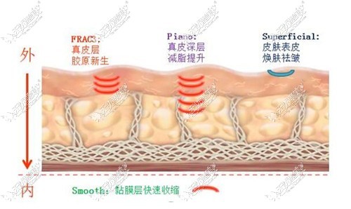 欧洲之星4D原理