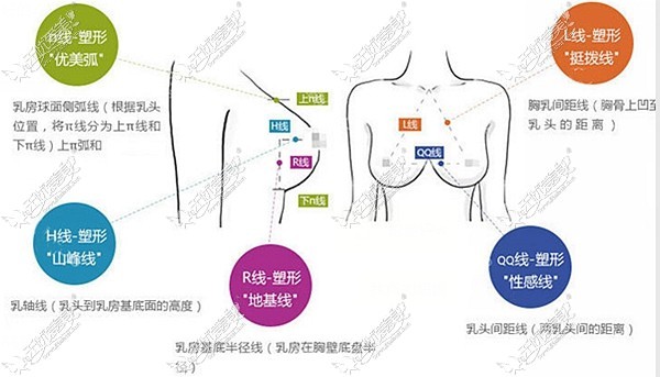 西安华仁假体隆胸比例