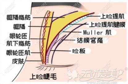 深圳艺星美杜莎美眼技术