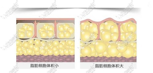 变胖的都是脂肪细胞