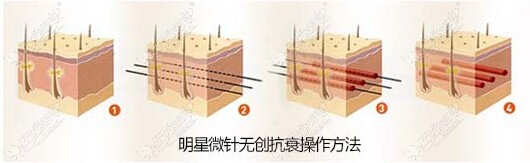 洛阳王静童颜术 