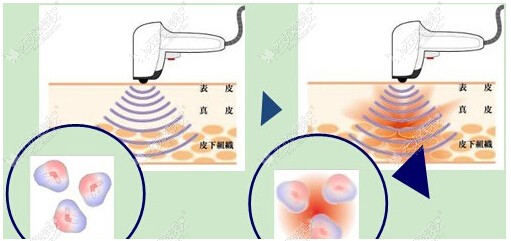 洛阳王静童颜术 