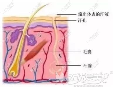 激光脱毛后不影响排汗