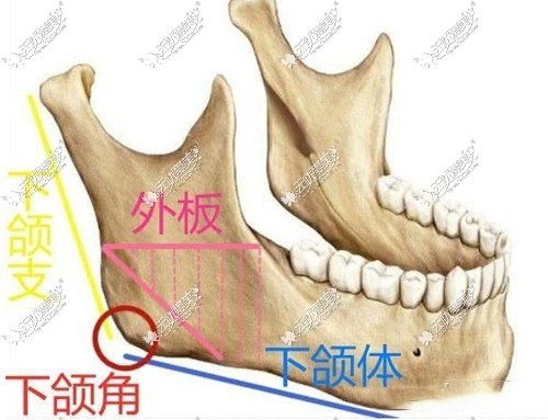 下颌角外板位置