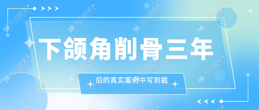 下颌角削骨三年后的真实案例中写到截骨后增生厉害不可信