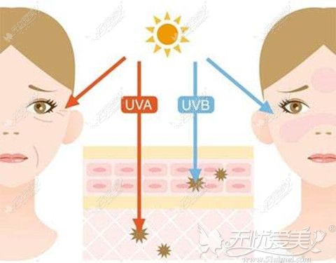 紫外线对皮肤暴晒造成晒斑还会加速皮肤衰老