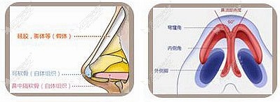 石家庄雅芳亚隆鼻整形