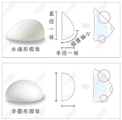 江苏施尔美假体隆胸形状