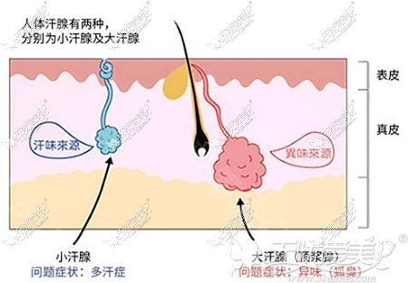 腋臭的产生过程