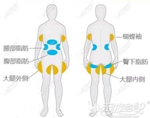 伊百丽整形冷冻溶脂适应部位