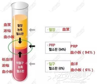 韩国贝缇莱茵PRP自体脂肪填充