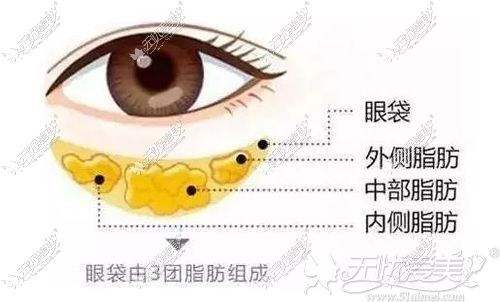 眼袋的组成